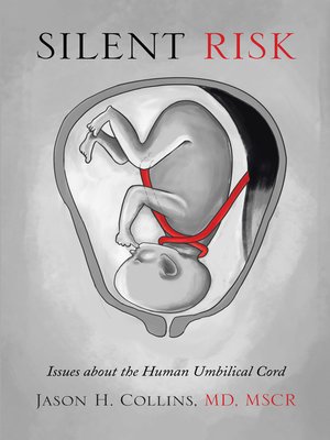 cover image of Silent Risk